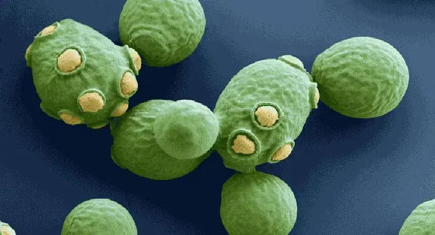 O que são leveduras? O que é Saccharomyces Cerevisiae?